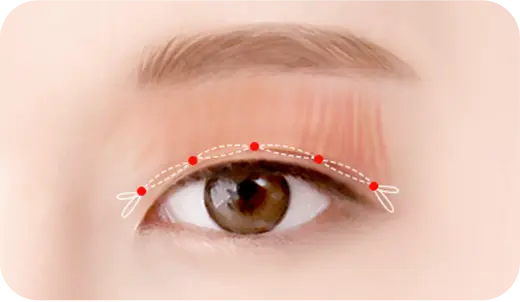 STEP 3. 显微操作