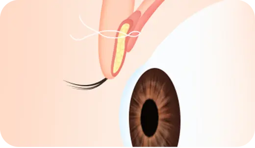 STEP 4. 生理性塑形